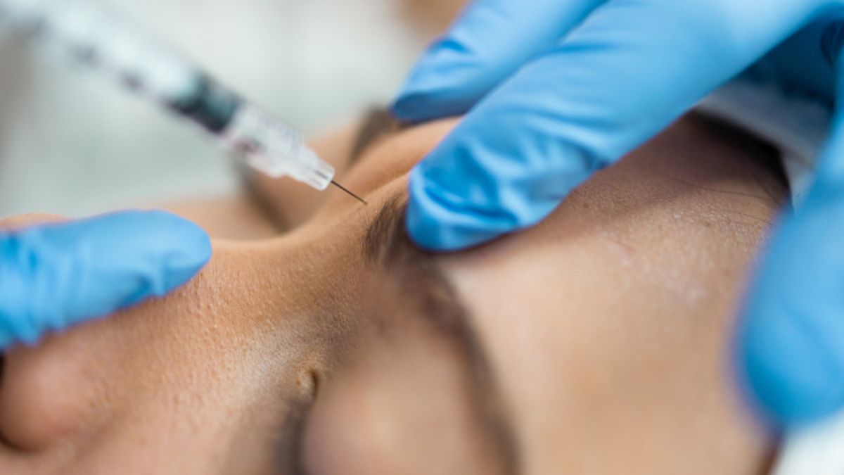 los metodos existen para realizarse un levantamiento de cejas botox