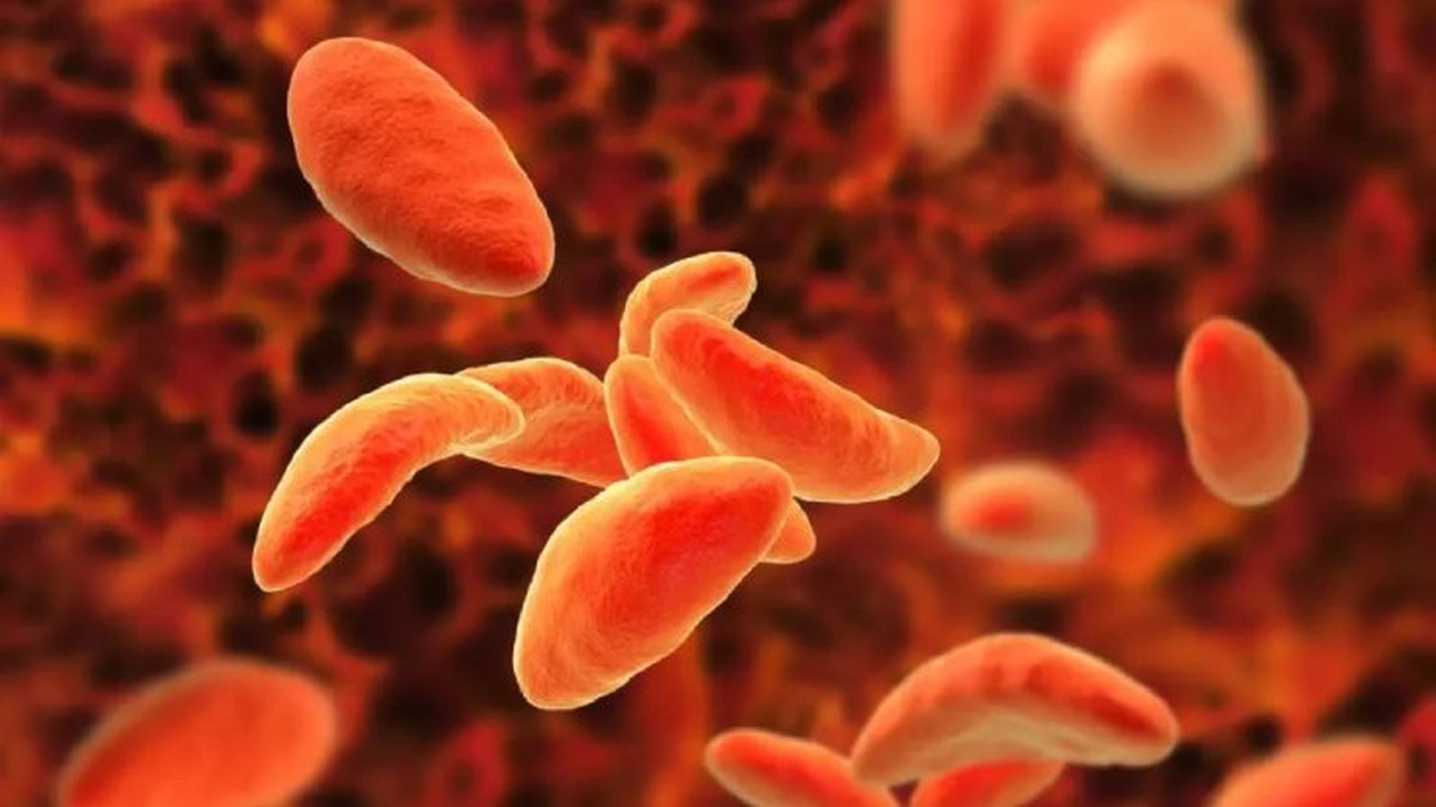 toxoplasmosis en gatos 1 toxoplasmosis en gatos 1