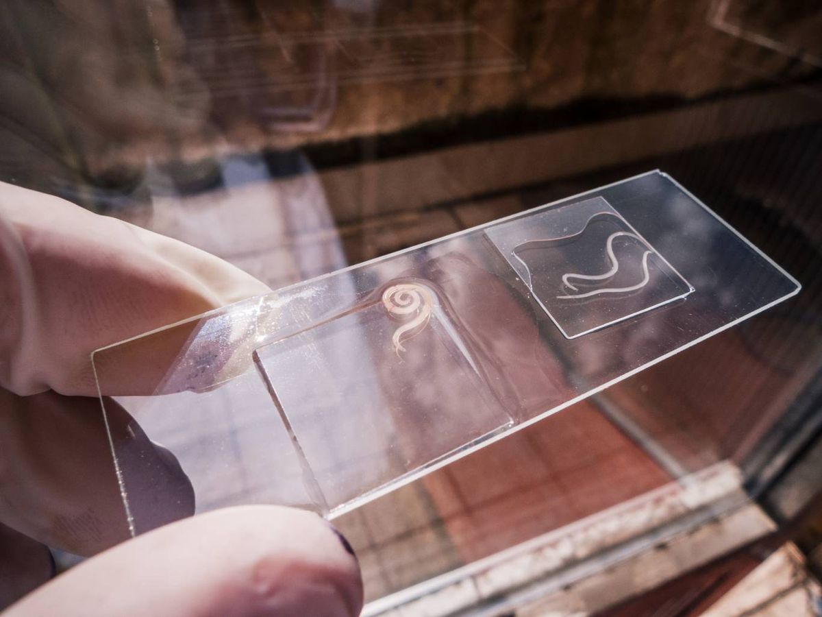 Observación de una larva de anisakis al microscopio.