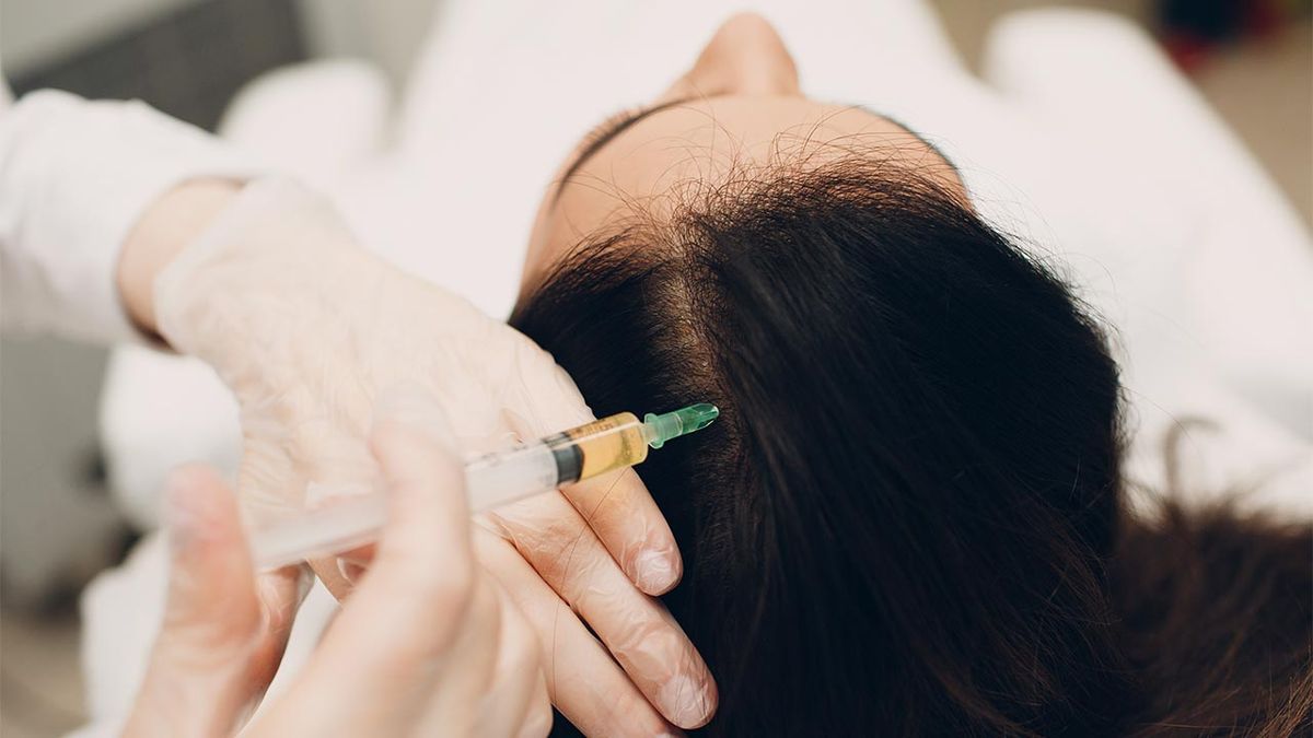 belleza tratamiento capilar plasma crecimiento pelo