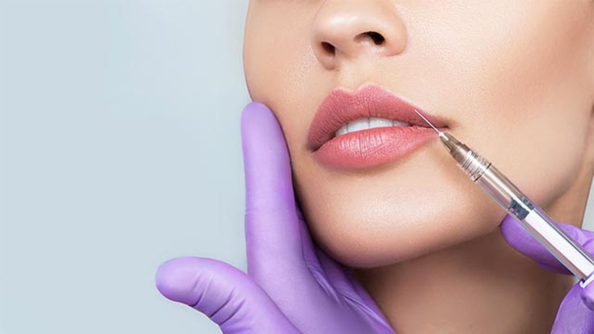 todo lo que debes saber sobre el aumento de labios sin cirugia aguja
