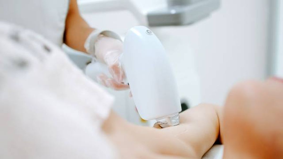 depilacion integral con laser