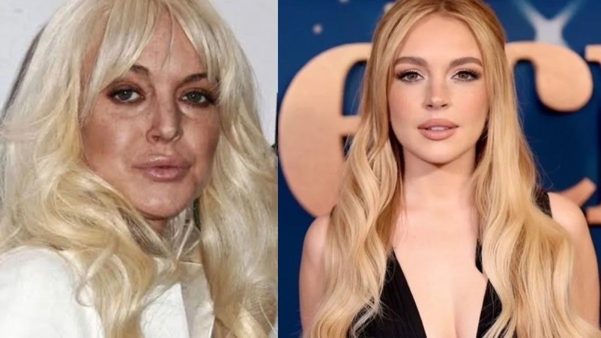 Lindsay Lohan antes y después de someterse a la medicina regenerativa