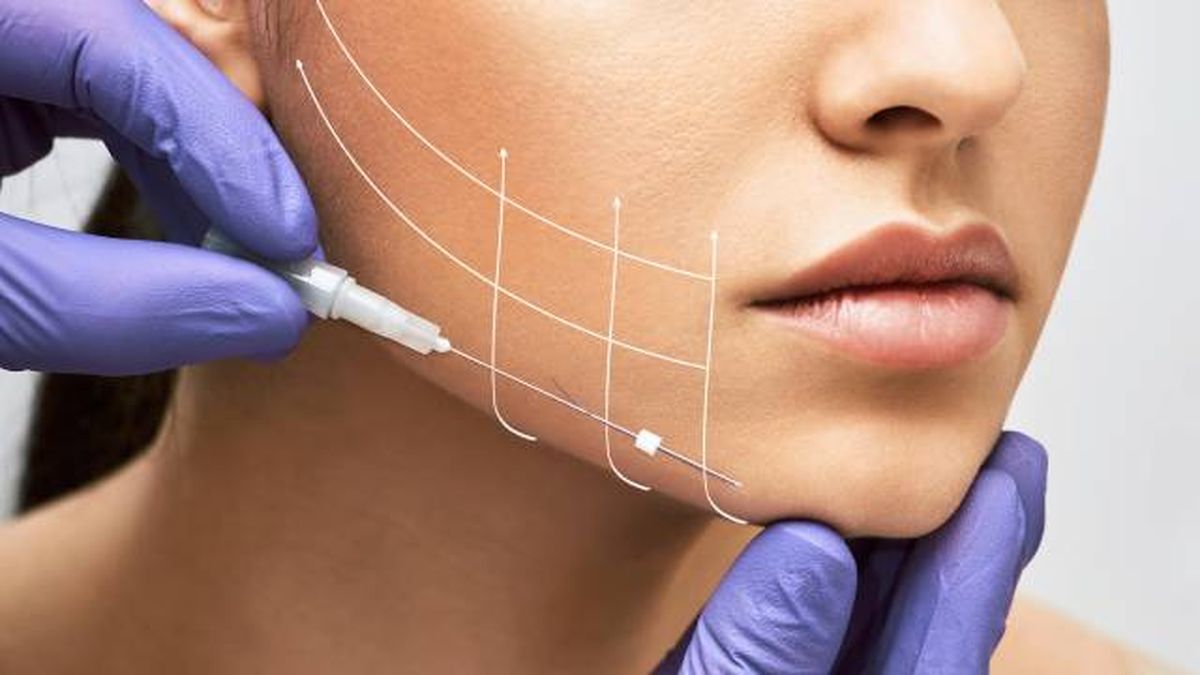 hilos tensores aplicacion