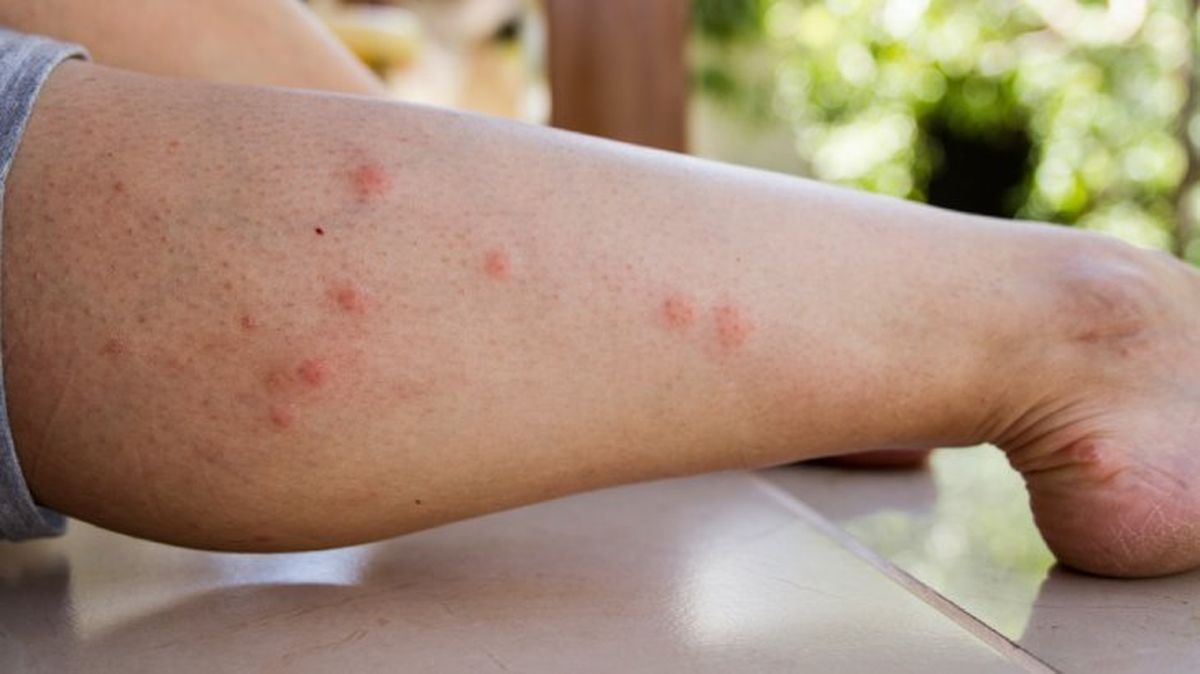 que pasaria si desaparecieran los mosquitos 7