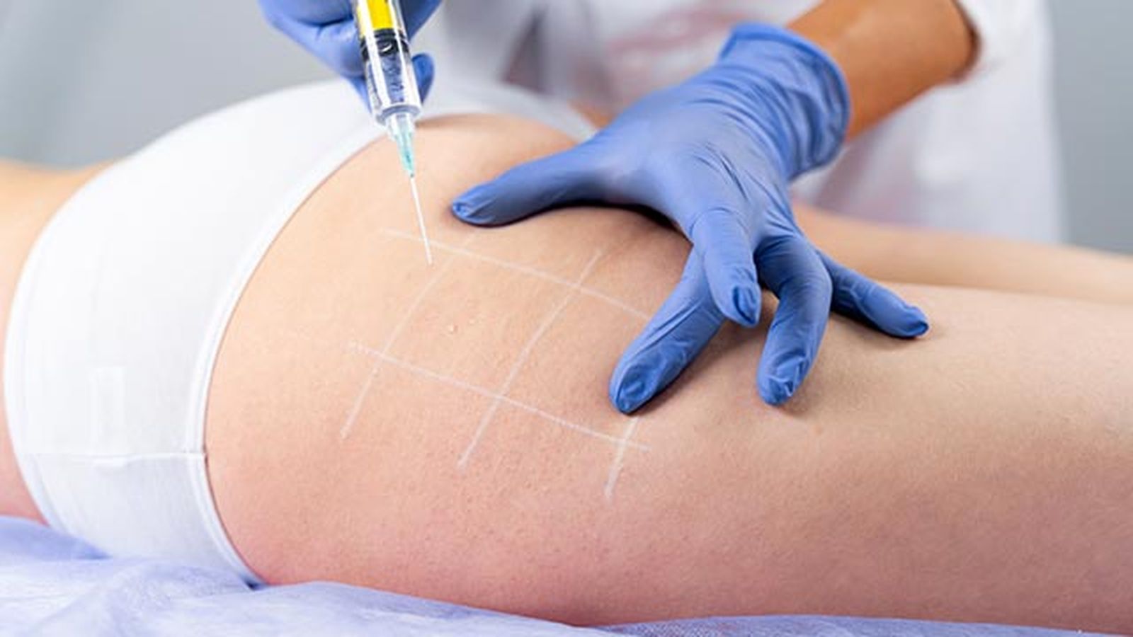 las 4 mejores cremas reafirmantes para decirle adios a la flacidez mesoterapia las 4 mejores cremas reafirmantes para decirle adios a la flacidez mesoterapia