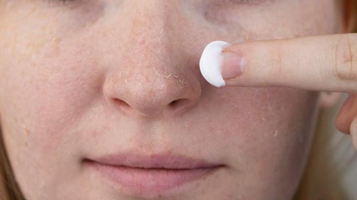 piel seca rostro como cuidarla y evitar la aparicion de arrugas