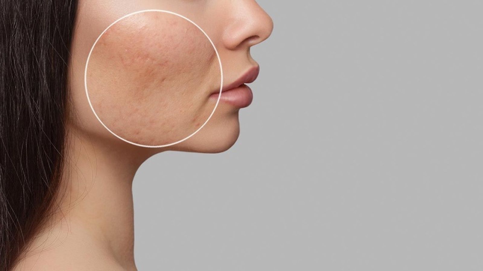 El retinol regula la producción de sebo del rostro.