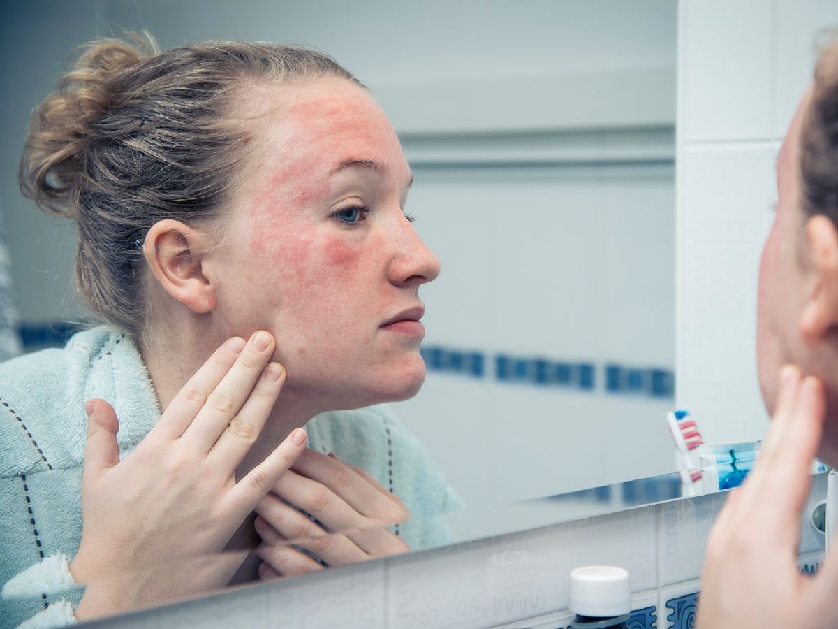 Acude al dermatólogo ante cualquier síntoma en tu piel