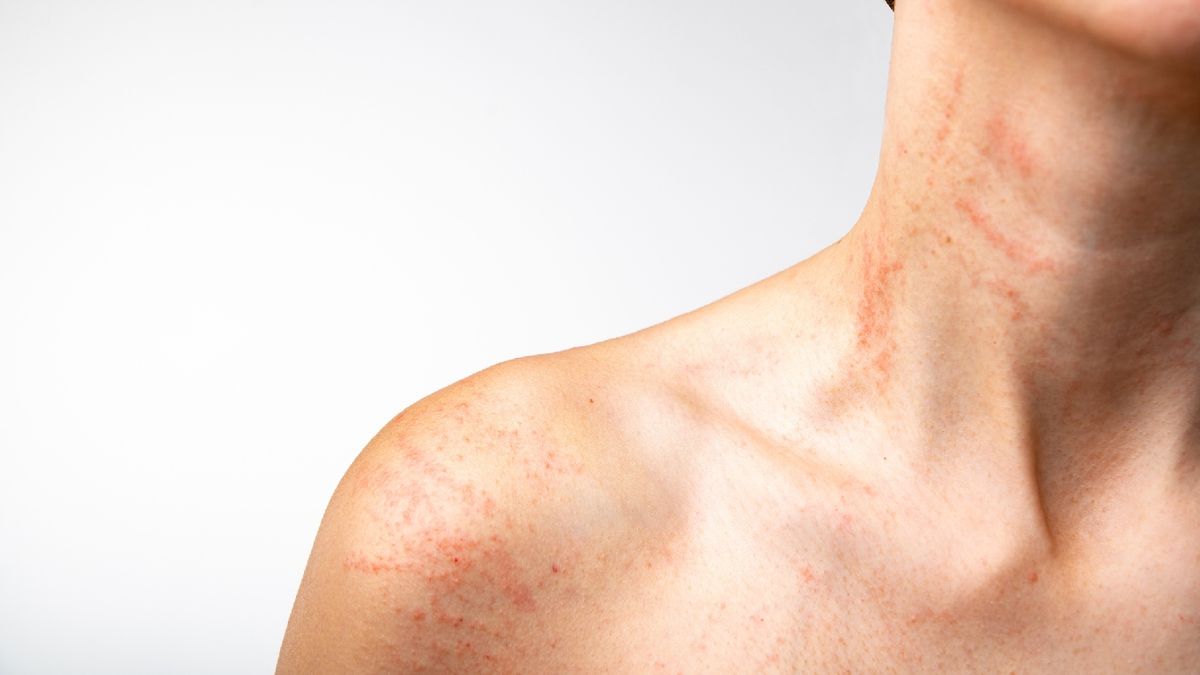 Ten especial cuidado con los perfúmenes en verano