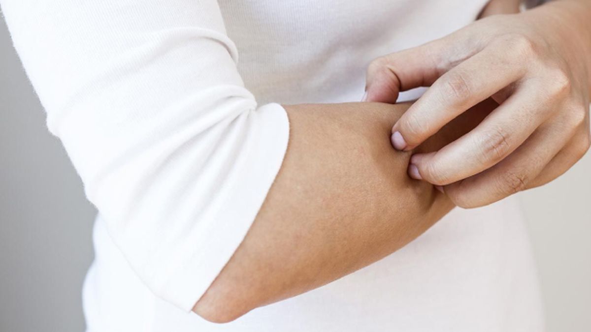 efectos de la contaminacion en la piel eccemas (1)