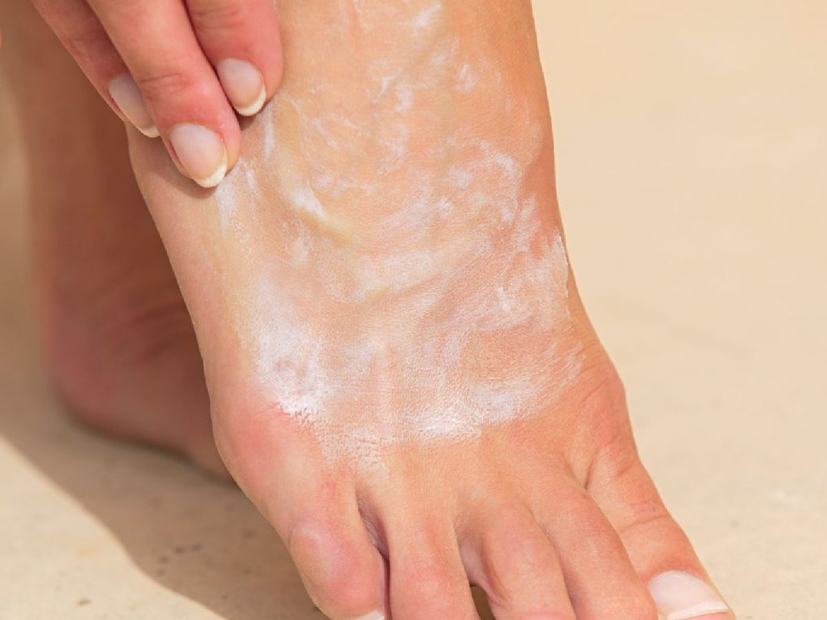 Algunas zonas son más propensas al daño solar