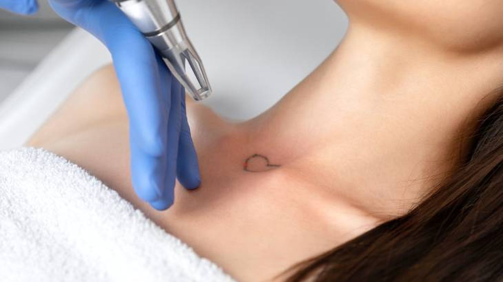 eliminar tatuaje laser eliminar tatuaje laser