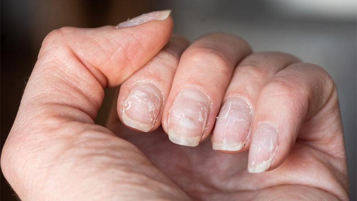 unas amarillas por esmalte como evitarlo debiles