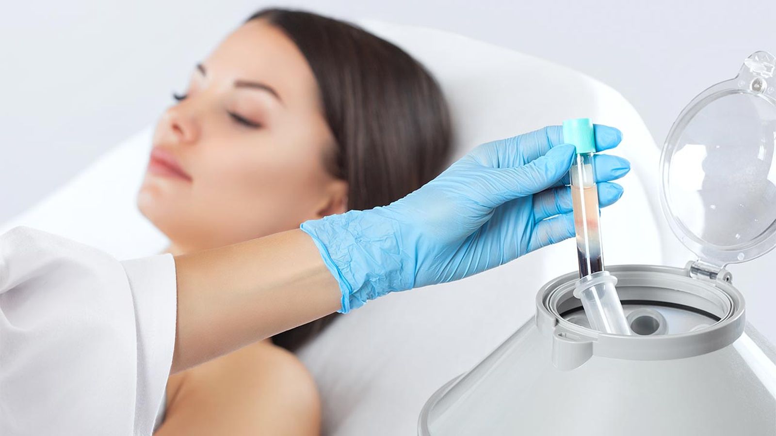belleza PRP capilar tratamiento plasma rico plaquetas maquina centrifugadora sangre belleza PRP capilar tratamiento plasma rico plaquetas maquina centrifugadora sangre