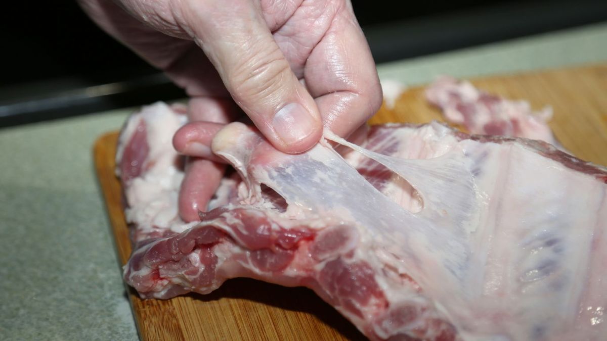 Membrana de las costillas