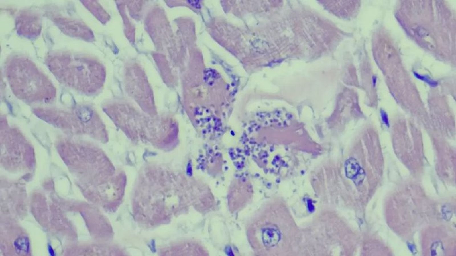 toxoplasmosis en gatos 4 toxoplasmosis en gatos 4
