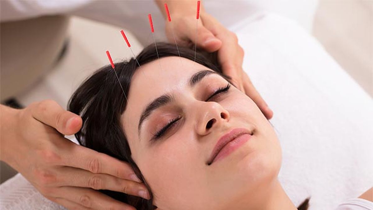 acupuntura facial que es y beneficios 1