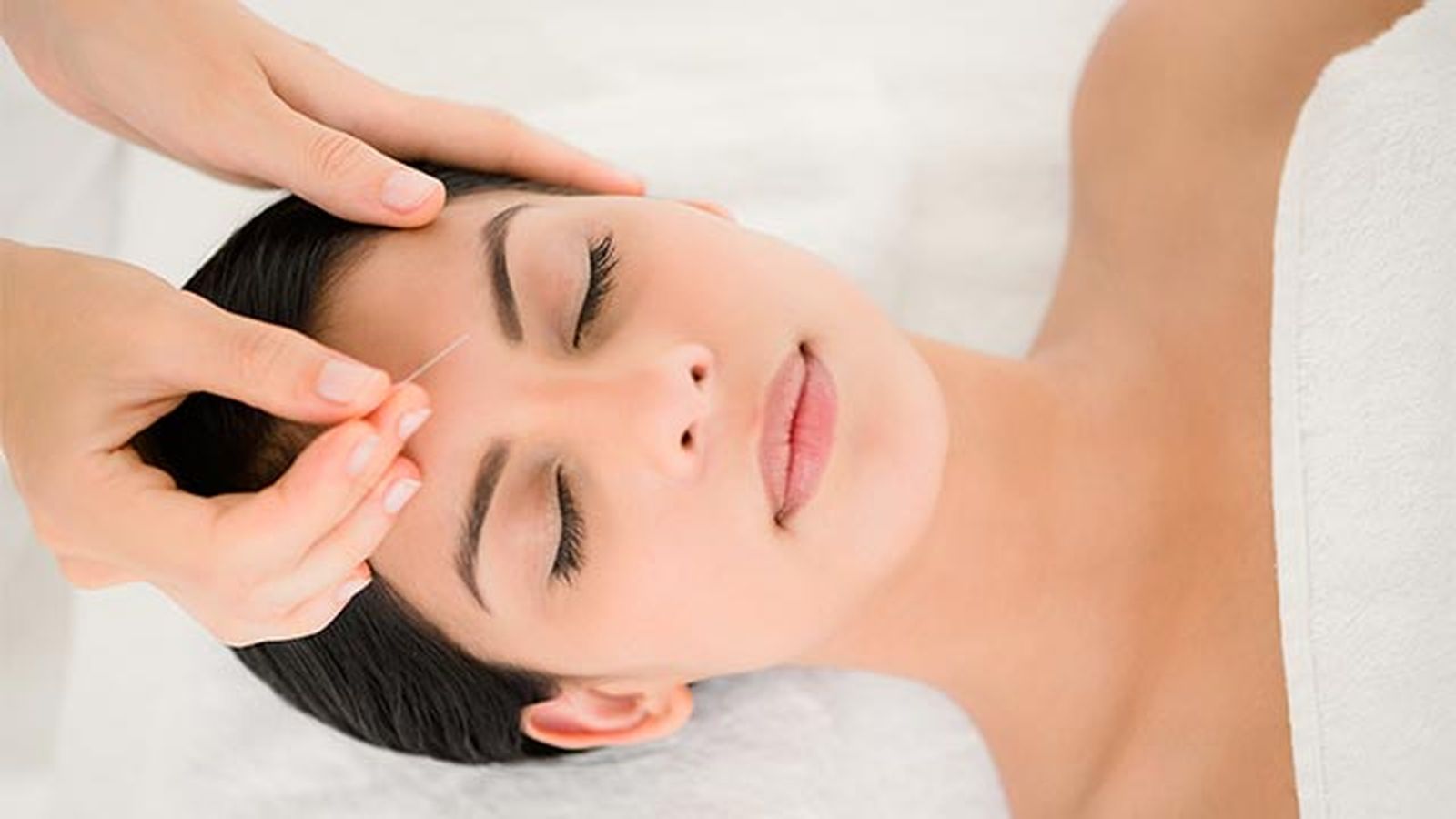 acupuntura facial que es y beneficios 3 acupuntura facial que es y beneficios 3