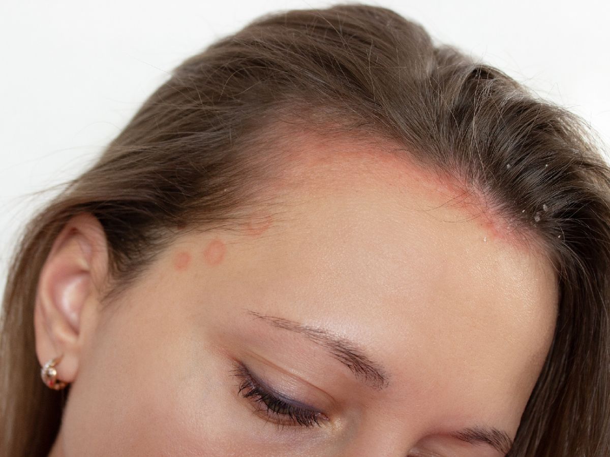 Si tu piel es especialmente sensible extrema la precaución