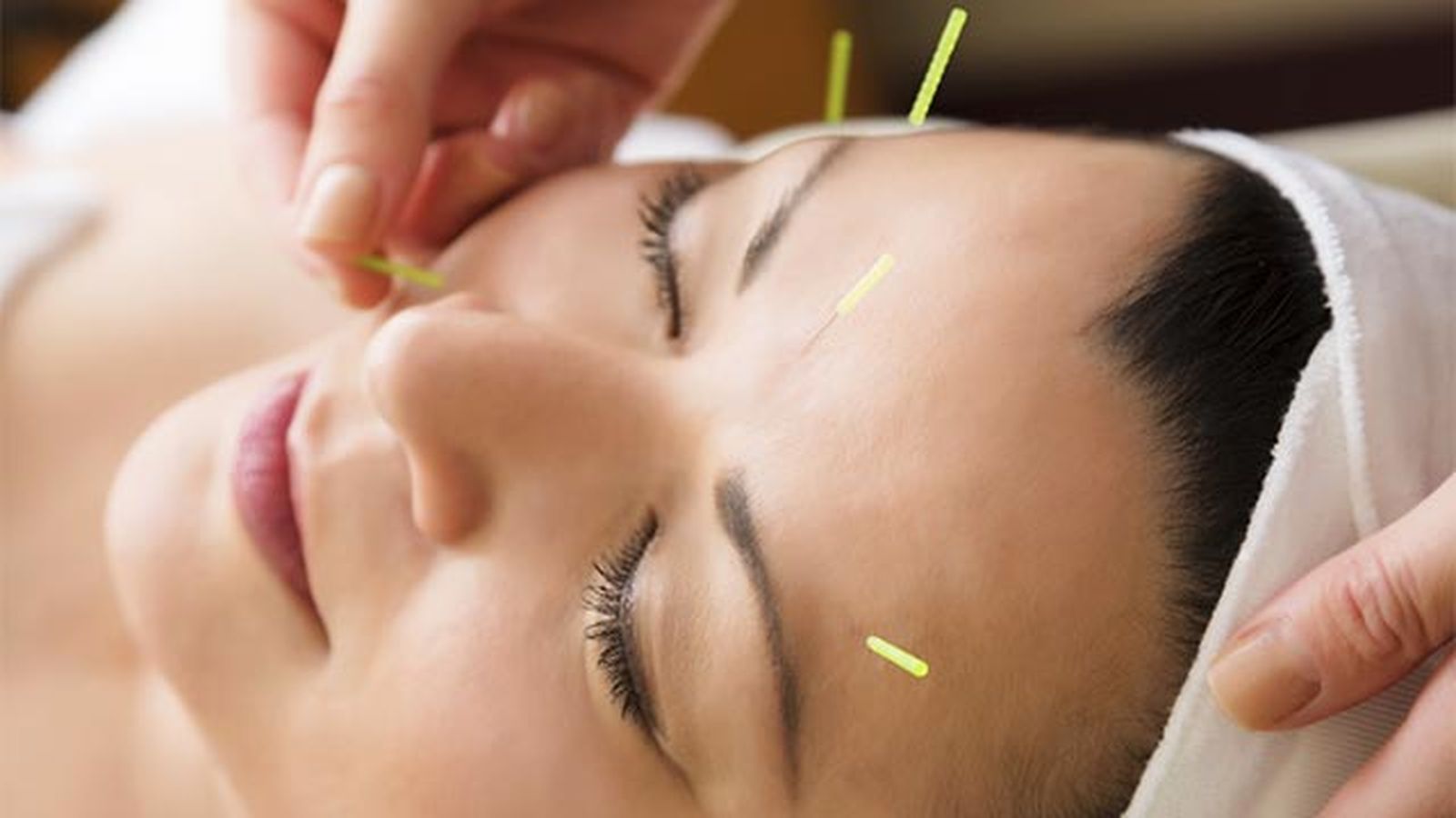 acupuntura facial que es y beneficios 2 acupuntura facial que es y beneficios 2